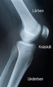 Knäled